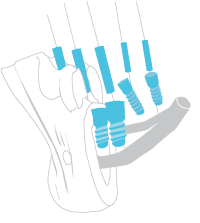 dreidimensionale CT oder DVT Aufnahme
