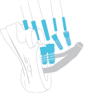 dreidimensionale CT oder DVT Aufnahme