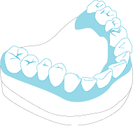 Totale Prothese Totale Prothese